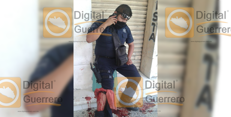 policia_auxiliar_herido_acapulco