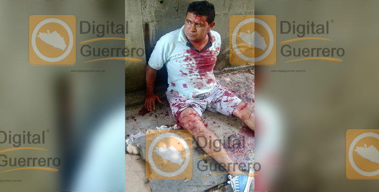 taxista_herido_sitio_acapulco