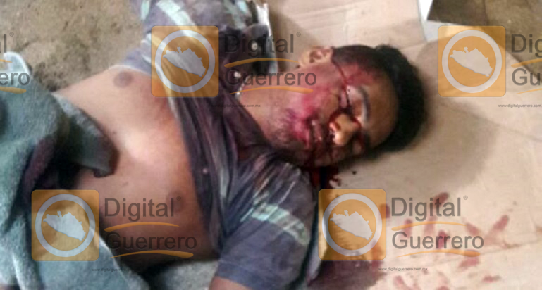 hombre_accidente_azotea_acapulco